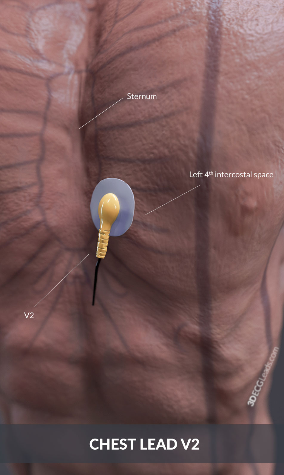 how to put ecg leads on chest